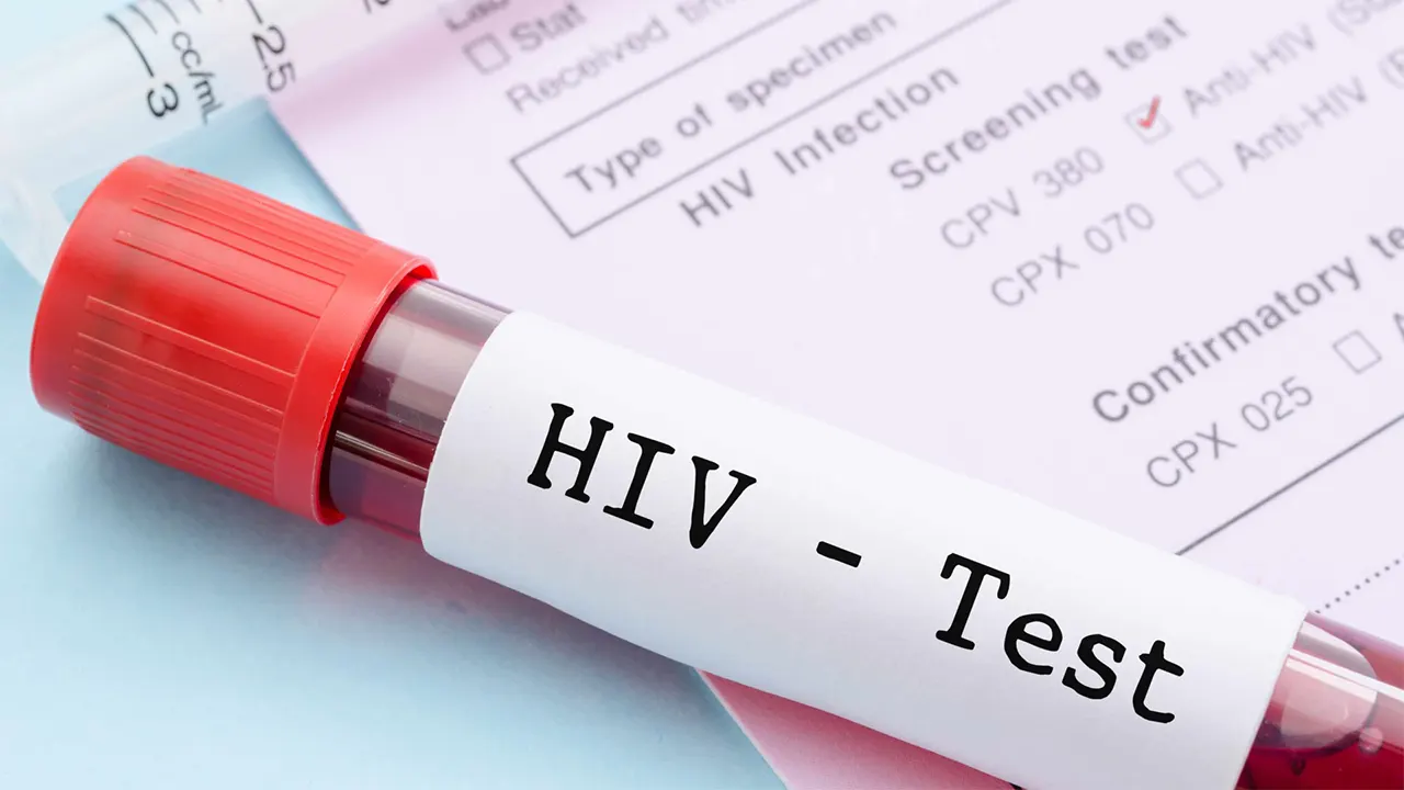 Harga HIV Test Klinik Swasta dan Kerajaan